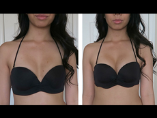 Upbra before and after